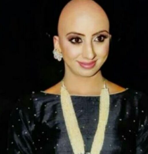 ನಟಿ ಸಂಜನಾ ಬೋಳು ತಲೆಯ ಹಿಂದಿನ ವಿಷ್ಯ ಏನು?