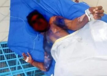 ಪತಿಯ ಗುಪ್ತಾಂಗಕ್ಕೆ ಬಿಸಿ ನೀರು ಎರಚಿದ ಪತ್ನಿ