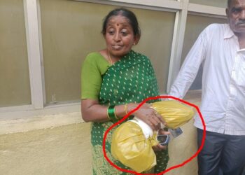 ಪತಿಯ ಕಾಲು ಕತ್ತರಿಸಿ ಪತ್ನಿಯ ಕೈಗಿಟ್ಟ ಆಸ್ಪತ್ರೆ ಸಿಬ್ಬಂದಿ..!