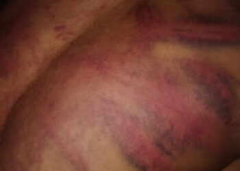 ಮುಸ್ಲಿಂ ಯುವಕನಿಗೆ ಹಿಂದೂ ಯುವಕರ ತಂಡದಿಂದ ಹಿಗ್ಗಾಮುಗ್ಗಾ ಹಲ್ಲೆ