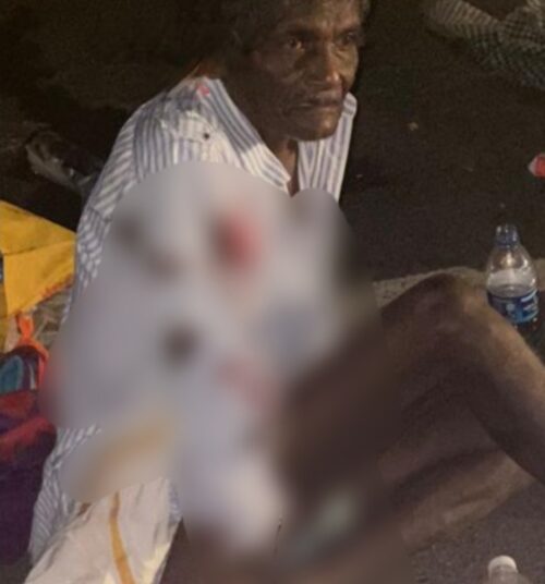 ಕೊರಗಜ್ಜ ಹೆಸರಿನ ವ್ಯಕ್ತಿಯ ಕೂರಿಸಿಕೊಂಡು ಬಂದ ರಿಕ್ಷಾ ಪಲ್ಟಿ, ರಕ್ತದ ಮಡುವಿನಲ್ಲಿ ಬಿದ್ದಿದ್ದ ಅಜ್ಜನನ್ನು ಬಿಟ್ಟು ಹೋದವನಿಗೆ ಆಗಿದ್ದೇನು ಗೊತ್ತಾ?