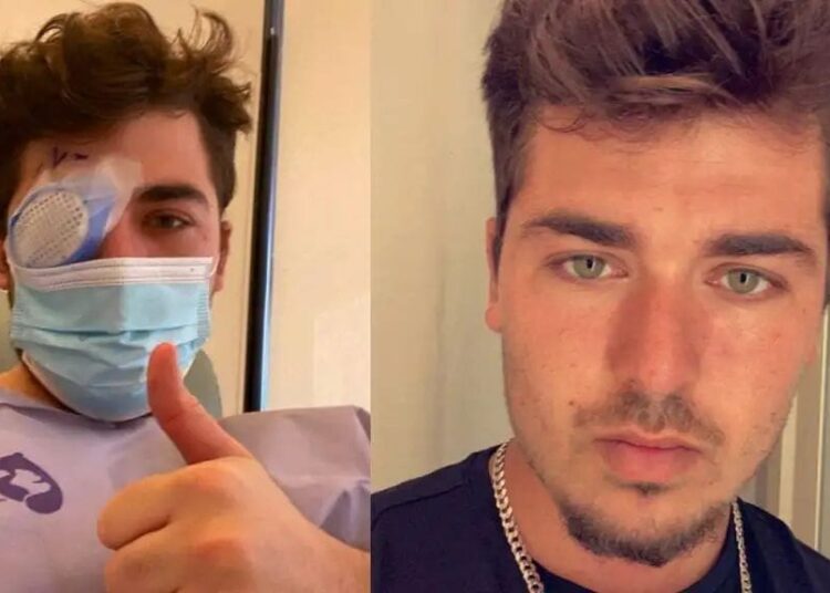 ಕಾಂಟ್ಯಾಕ್ಟ್ ಲೆನ್ಸ್ ಗಳನ್ನು ಧರಿಸುವ ಪ್ರತಿಯೊಬ್ಬರು ತಿಳಿದುಕೊಳ್ಳಬೇಕಾದ ಸಂಗತಿ,ಇಲ್ಲವಾದಲ್ಲಿ ಈ ಗತಿ ನಿಮಗೂ ಆಗಬಹುದು,ಎಚ್ಚರ!