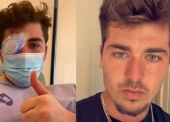 ಕಾಂಟ್ಯಾಕ್ಟ್ ಲೆನ್ಸ್ ಗಳನ್ನು ಧರಿಸುವ ಪ್ರತಿಯೊಬ್ಬರು ತಿಳಿದುಕೊಳ್ಳಬೇಕಾದ ಸಂಗತಿ,ಇಲ್ಲವಾದಲ್ಲಿ ಈ ಗತಿ ನಿಮಗೂ ಆಗಬಹುದು,ಎಚ್ಚರ!