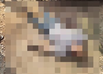 ಉಪ್ಪಿನಂಗಡಿಯಲ್ಲಿ ಭೀಕರ ರಸ್ತೆ ಅಪಘಾತ:ಬೈಕ್ ಸವಾರ ಗಂಭೀರ