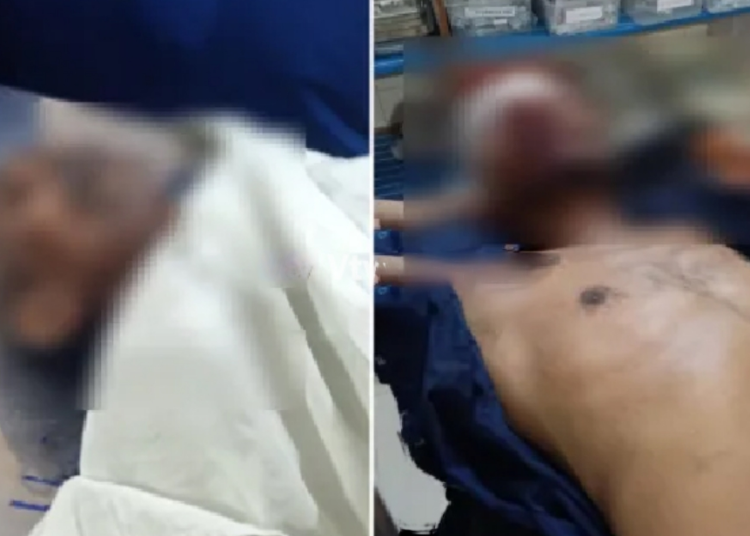 ಪುತ್ತೂರು:ಭೀಕರ ರಸ್ತೆ ಅಪಘಾತ, ಪಾದಚಾರಿ ಮೃತ್ಯು,ಉಬರಡ್ಕ ನಿವಾಸಿ ಬೈಕ್ ಸವಾರ ಗಂಭೀರ